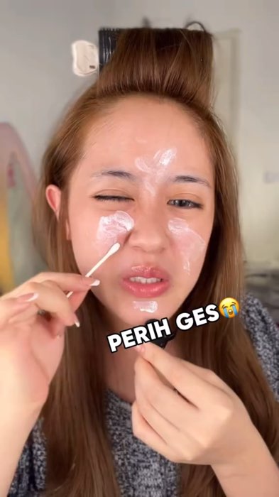 Hempaskan jerawat manja #RacunShopee #drleoacneessenceacnespot #drleo #obattotoljerawat #obatjerawat #skincare