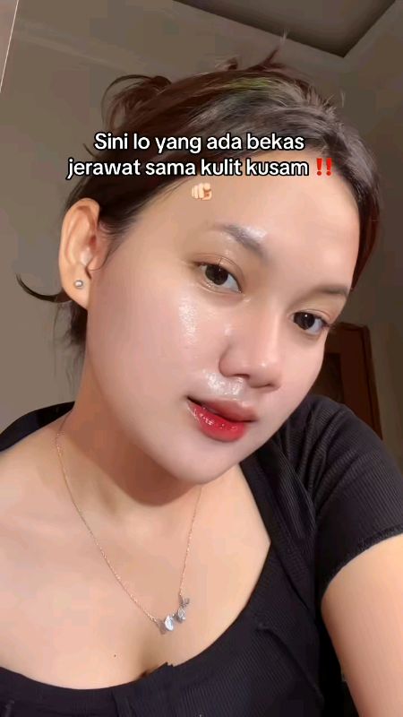glow up maksimal #RacunShopee #RacunShopeeCheck #ViralDiShopeeVideo #fypdongggggggg #skincareviral #skincareroutine #kymmskinglowing #kymmskincare
