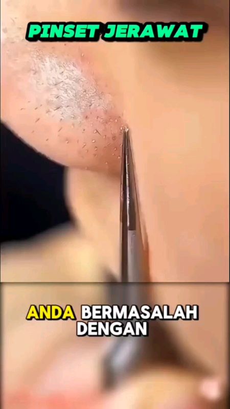 #pinsetkomedo #pinsetkomedohidung #pinsetstainless #RacunShopeeCheck #SpillBawaBerkah #SpillRacunShopee #jualanonline