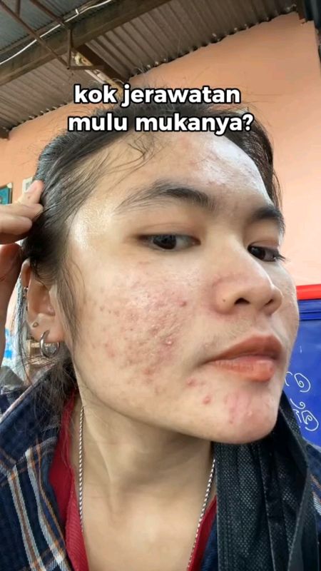 dr FAY Original Penghilang Bopeng flek hitam  jerawat  dan bekas jerawat #Drfaycreamoriginal #DRFAYdapatmencerahkanwajah #drfaybopeng