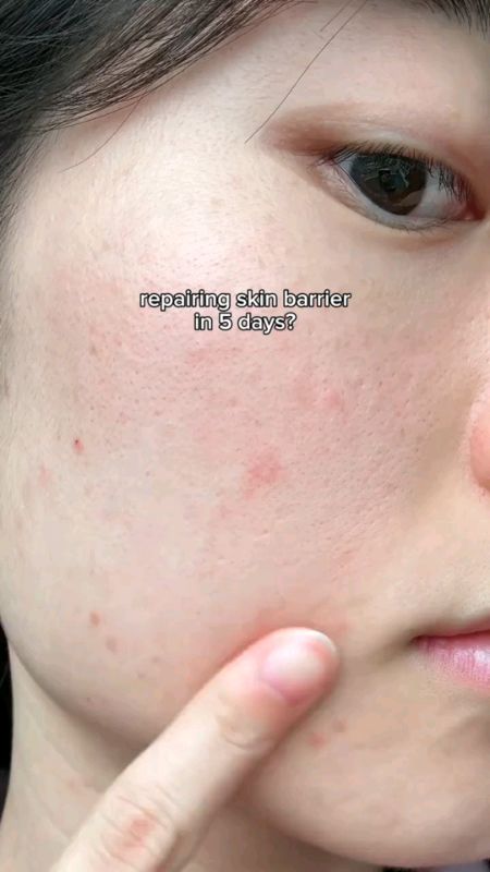 Skintific 5x ceramide #ShopeeHaul #ShopeeFinds #ShopeeReview #ShopeeMurah #ShopeeViral #ShopeeTips #ShopeeRekomendasi