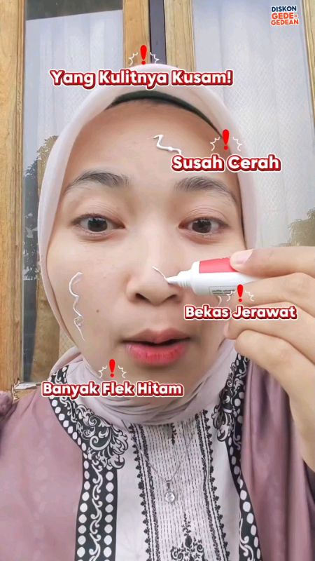 Banyak Flek? Kulit Kusam? Coba Paje Ini! #chalonese #creamflekhitam #chalonesebrighteningcream #ShopeeCOD #PromoNonStop #ViralDiShopeeVideo #CODinApa