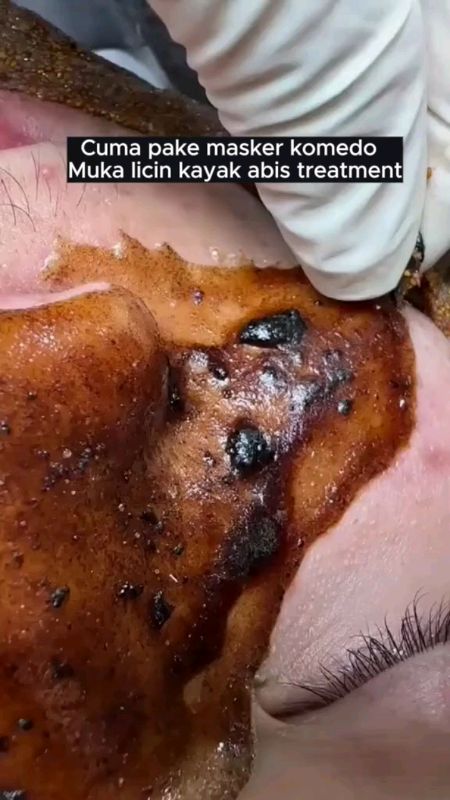 #maskerkomedo #sadoer #maskerarang #maskerwajah #maskerhitam #lewatberandafypシ #racunshopeecheeck #sorotanpublik #fypdongggggggg #semuaorang