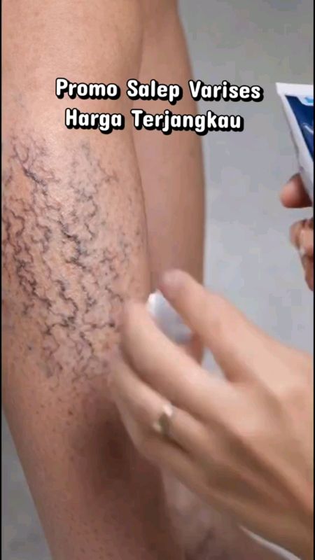 #salepvarises #racunshopeee #DiskonRacunShopee