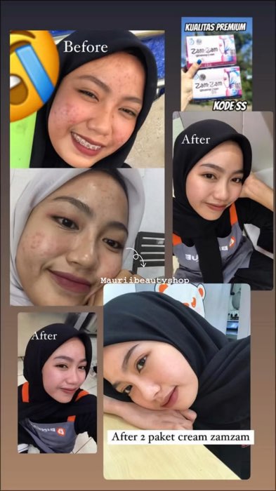 Diorder sygku lagi promo 2.2 loh😍🔥#zamzambpom #skincare #videoshopee #fyp #viral #zamzamJK