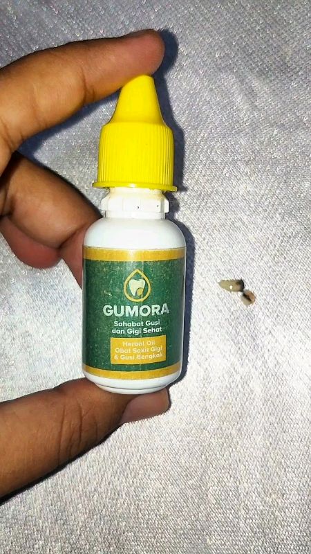 #gumora #gumoraherbaluntuksakitgigi #sakitgigi #sakitgigiberlubang #bebasongkirRp0 #Diskon40RB #IsiKeranjangOren #RacunShopee #