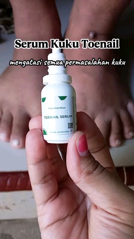 Atasi semua permasalahan kuku #Jamurkuku #cantengan #obatjamurkuku #obatcantengan #obatkukurusak #shopeevideo