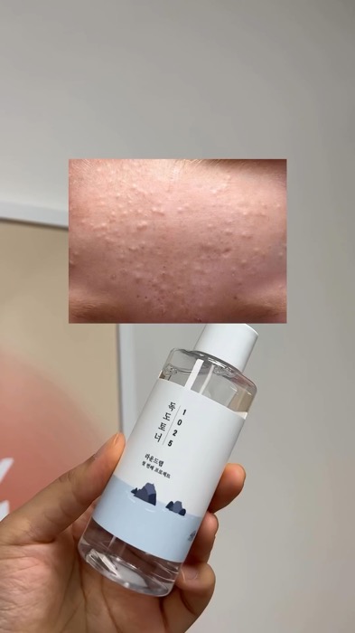 ￼Round Lab - 1025 Dokdo Toner#ShopeeBeautyHaul #RacunShopee #korea #viral #skintexture #acne #ekfoliasi #roundlab #dokdotoner #skincare #beauty
