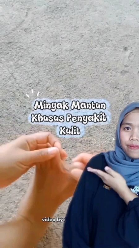 Kalau mau gatel cepet kering, rutin oles Minyak mantun yaa #MinyakMantun #minyakmantunmbahmijan #DiskonRacunShopee #RacunShopee