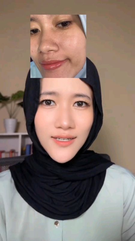 Kalon SBOOST bikin kulit aku sehat dan cerah #kalon