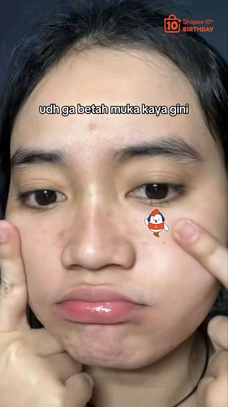 acne gel mask g2g 🔥✨ #g2g #g2gacne #acnegelmask #RacunShopee #SpillRacunShopee #SpillBawaBerkah #shopeevideo #ShopeeLook #ShopeeBeautyHaul