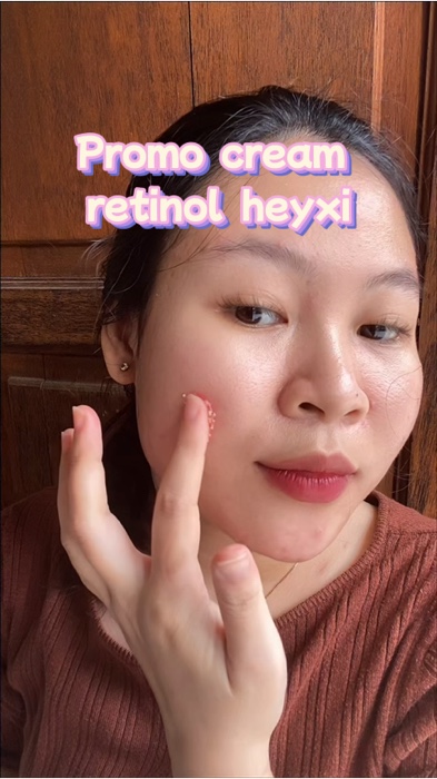 Ku sebut suhu kalau bisa cekout 2 pcs 50ribuan #heyxi #heyxicreamretinol #heyxidragonbloodcream #heyxiglowingcream #heyxiskincare #heyxiretinolcream