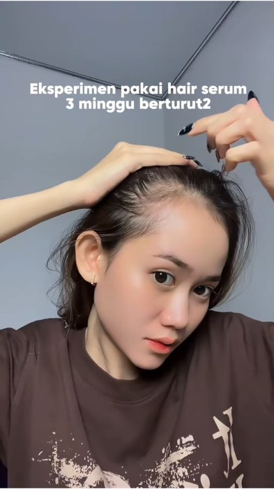 #hairserum #serum #haircare #haircareroutine #cyeecare #rambutrontok