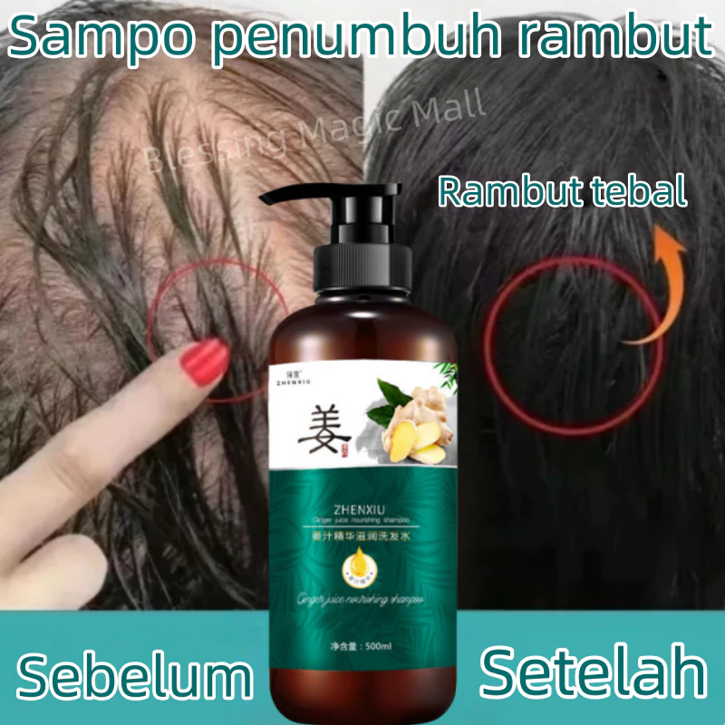 sampo penumbuh rambut cepat perawatan rambut rontok shampo rambut rontok ginger shampoo hair care Anti Ketombe Gatal Anti Rambut Rontok Fast Grow Shampoo 500ml