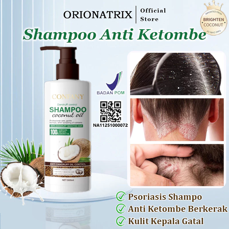 Orionatrix Shampo Anti Ketombe Coconut Shampoo Kutu Rambut Sampo Kelapa Menghilangkan Ketombe Shampo Penghilang Kutu Kulit Kepala Gatal Psoriasis Kulit Kepala Oil Control