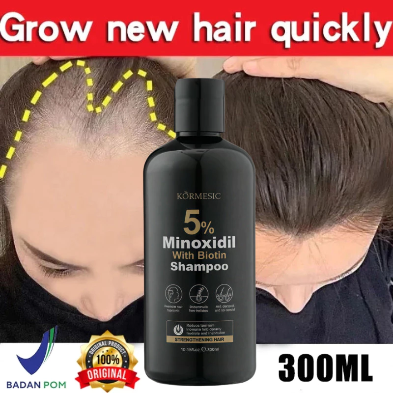 [100% ORI] Shampo Penumbuh Rambut Cepat Anti Rambut Rontok Botak Shampoo 300ml Botak Rontok Penumbuh Rambut Perawatan Hair Care Treatment Anti
